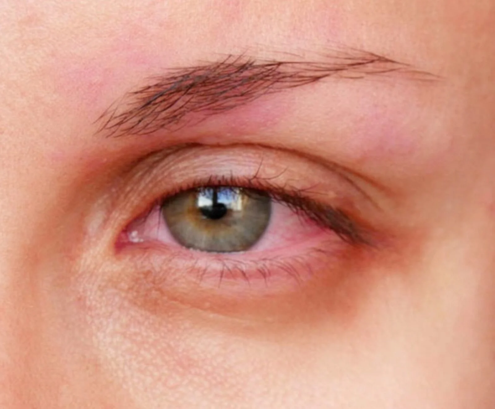 Test della lacrimazione